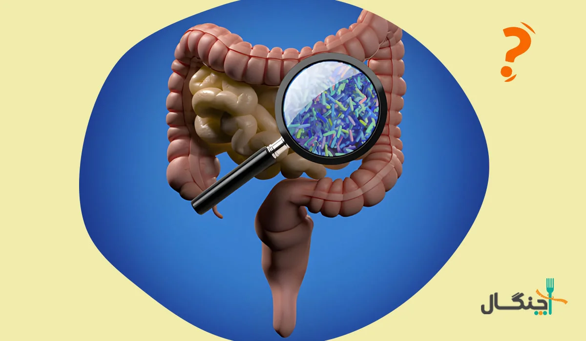 عدم تعادل میکروبیوم روده