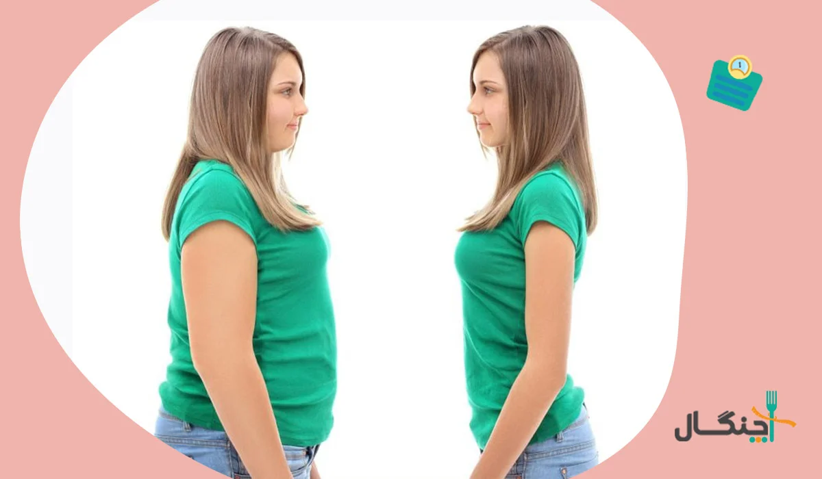 لاغری افراد خیلی چاق